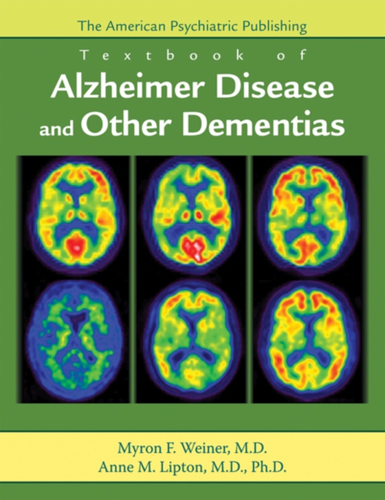 American Psychiatric Publishing Textbook of Alzheimer Disease and Other Dementias (e-bog) af -