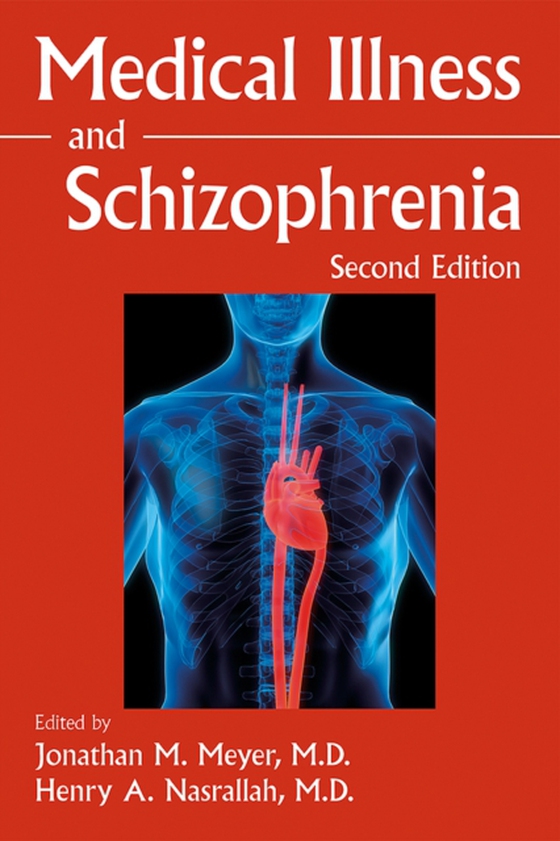 Medical Illness and Schizophrenia (e-bog) af -