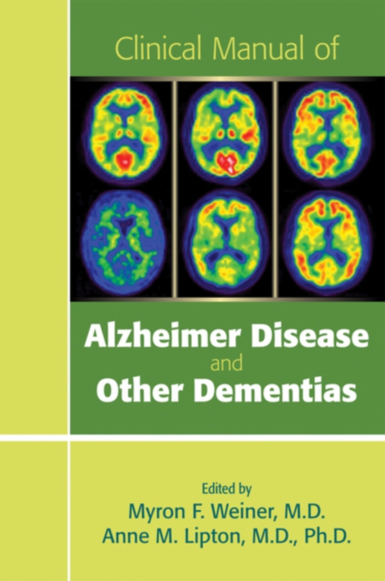 Clinical Manual of Alzheimer Disease and Other Dementias (e-bog) af -