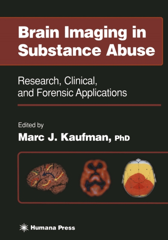 Brain Imaging in Substance Abuse (e-bog) af -