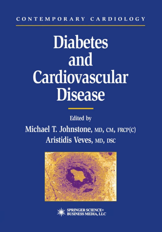 Diabetes and Cardiovascular Disease (e-bog) af -