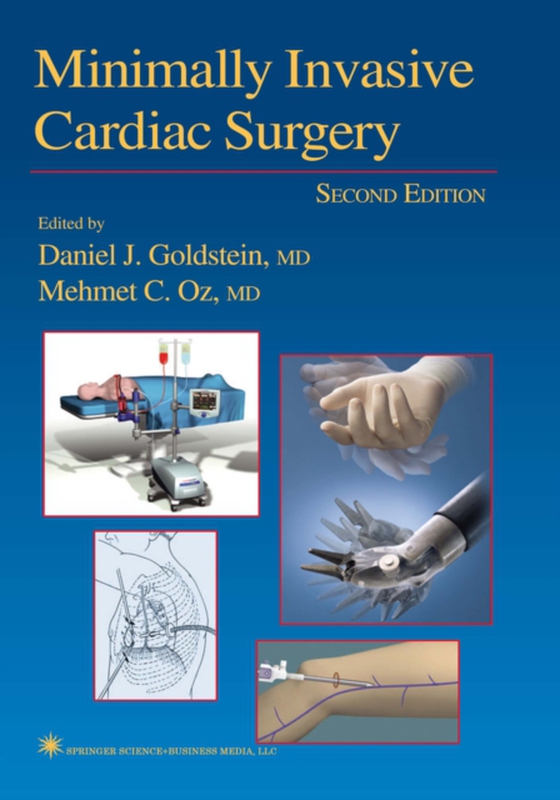 Minimally Invasive Cardiac Surgery (e-bog) af -