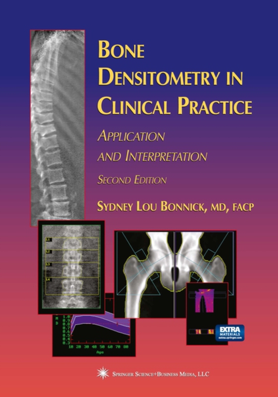 Bone Densitometry in Clinical Practice (e-bog) af Bonnick, Sydney Lou