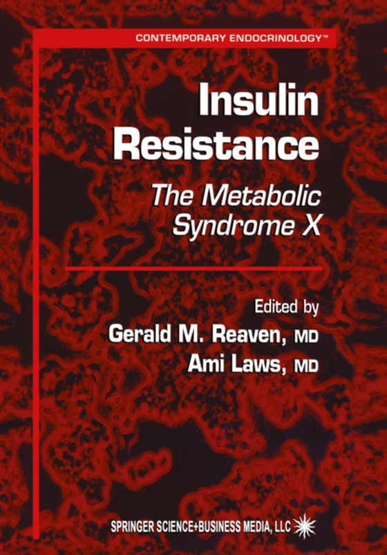 Insulin Resistance (e-bog) af -