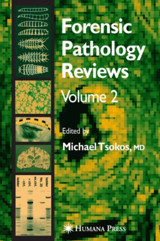 Forensic Pathology Reviews Vol    2 (e-bog) af -