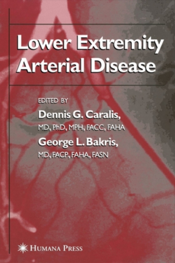 Lower Extremity Arterial Disease (e-bog) af -