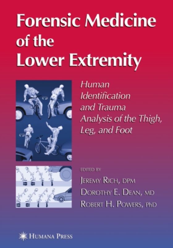 Forensic Medicine of the Lower Extremity (e-bog) af -