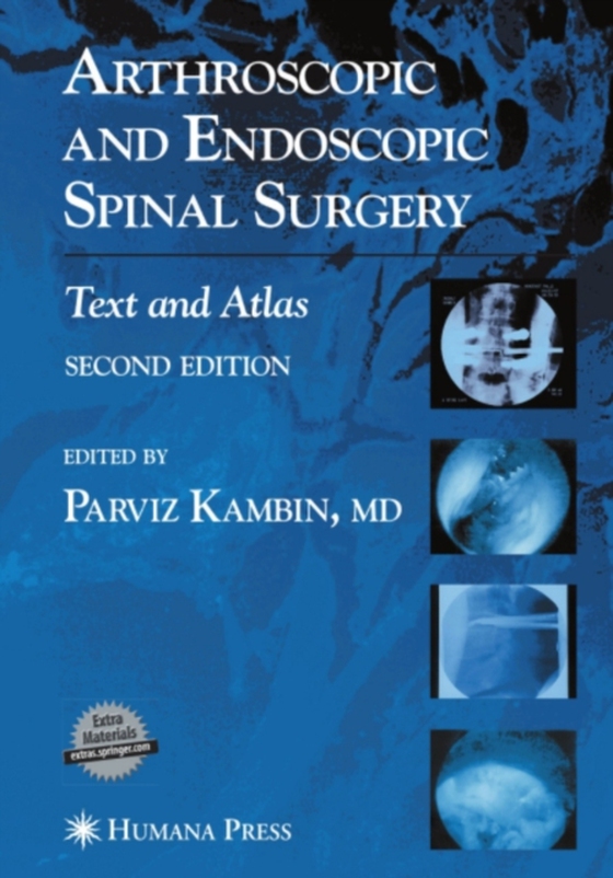 Arthroscopic and Endoscopic Spinal Surgery (e-bog) af -