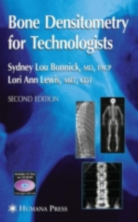 Bone Densitometry for Technologists (e-bog) af Bonnick, Sydney Lou