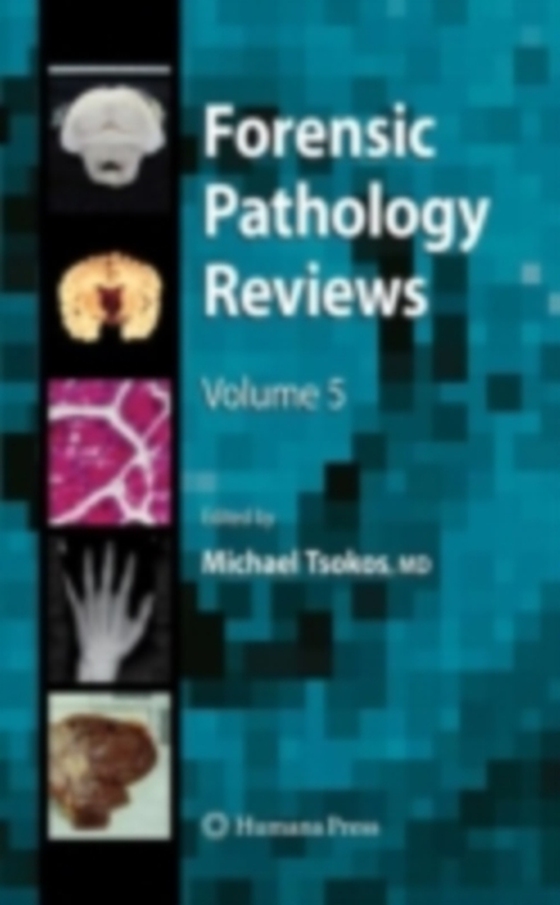 Forensic Pathology Reviews 5 (e-bog) af -