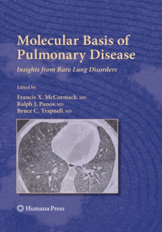 Molecular Basis of Pulmonary Disease (e-bog) af -