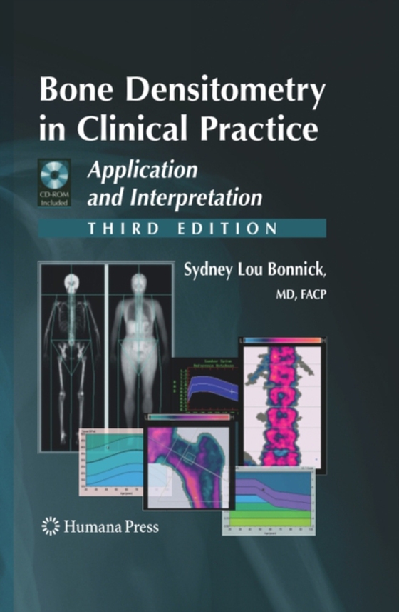 Bone Densitometry in Clinical Practice (e-bog) af Bonnick, Sydney Lou