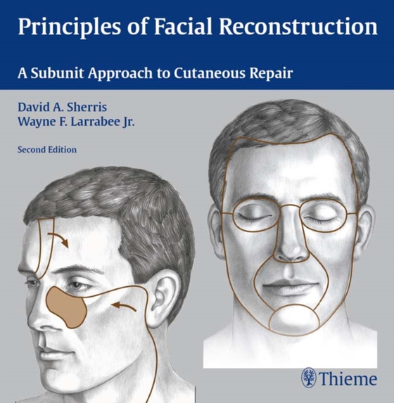 Principles of Facial Reconstruction (e-bog) af -