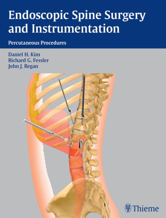 Endoscopic Spine Surgery and Instrumentation (e-bog) af -