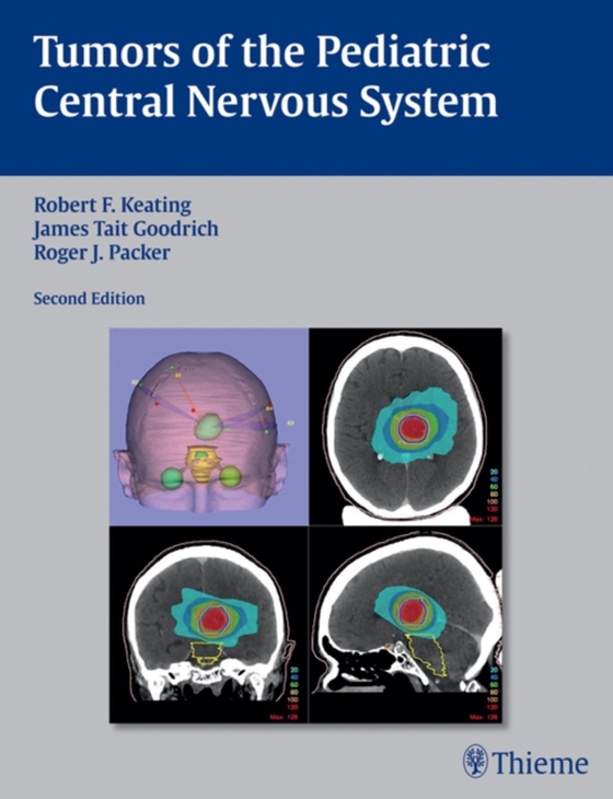 Tumors of the Pediatric Central  Nervous System (e-bog) af Packer, Roger