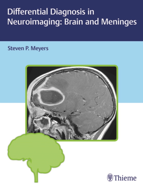 Differential Diagnosis in Neuroimaging: Brain and Meninges (e-bog) af -