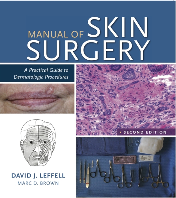 Manual of Skin Surgery (e-bog) af Marc D. Brown, MD