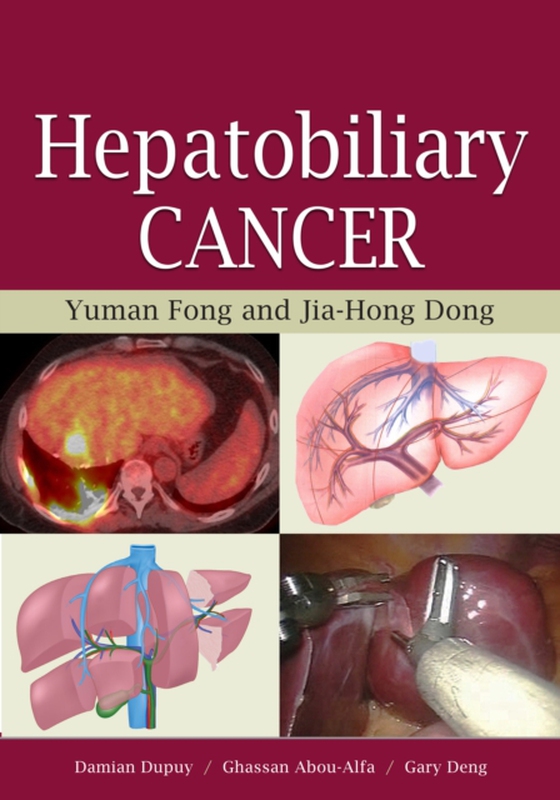 Hepatobiliary Cancer (e-bog) af Fong, Yuman