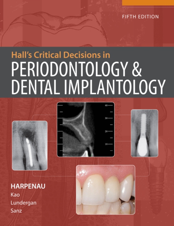 Hall's Critical Decisions in Periodontology & Dental Implantology, 5e (e-bog) af Harpenau, Lisa