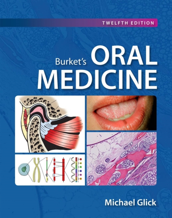 Burket's Oral Medicine, 12e