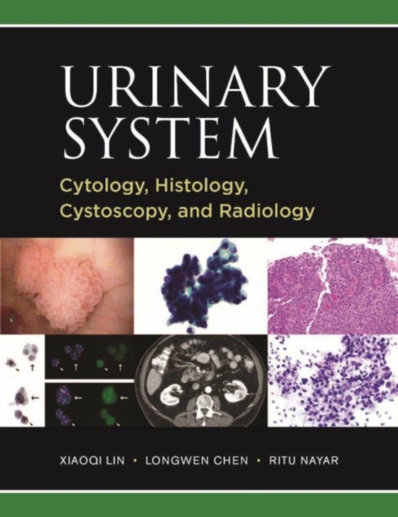 Urinary System: Cytology, Histology, Cystoscopy, and Radiology (e-bog) af -