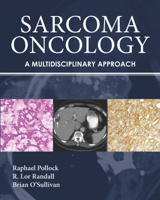 Sarcoma Oncology (e-bog) af -