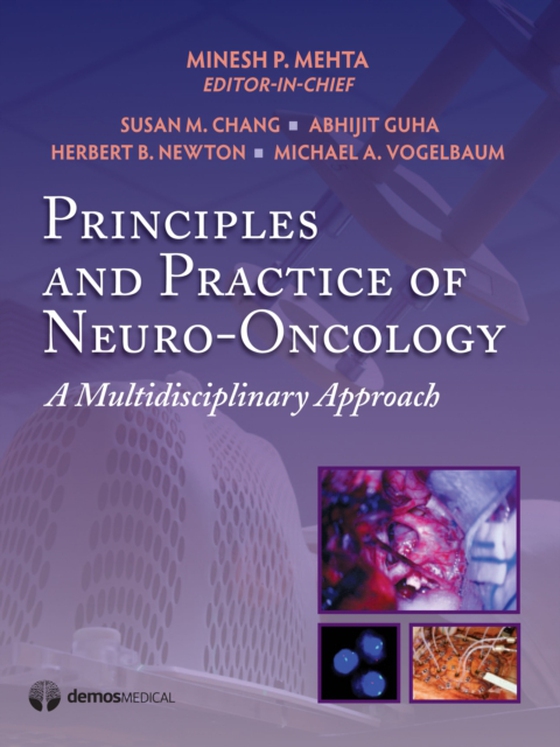 Principles & Practice of Neuro-Oncology (e-bog) af -