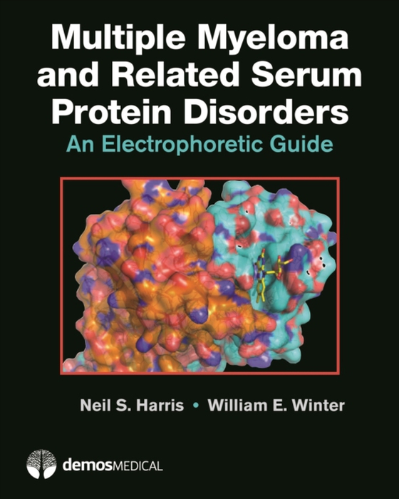 Multiple Myeloma and Related Serum Protein Disorders (e-bog) af Winter, William E.