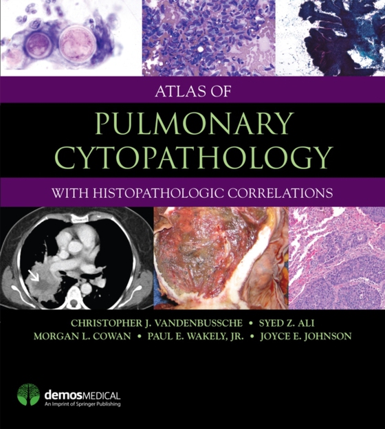 Atlas of Pulmonary Cytopathology (e-bog) af Joyce E. Johnson, MD