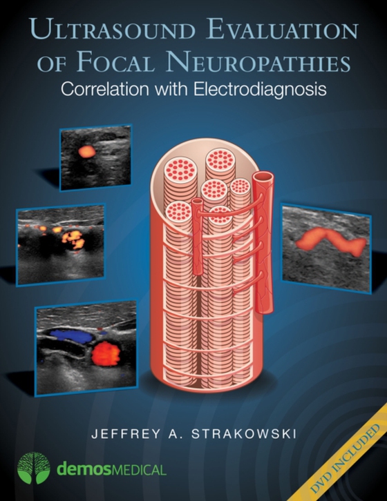 Ultrasound Evaluation of Focal Neuropathies (e-bog) af Jeffrey A. Strakowski, MD