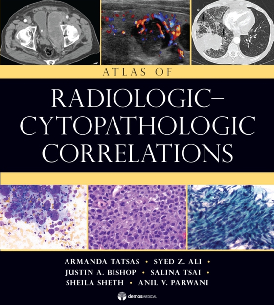 Atlas of Radiologic-Cytopathologic Correlations (e-bog) af Salina Tsai, MD