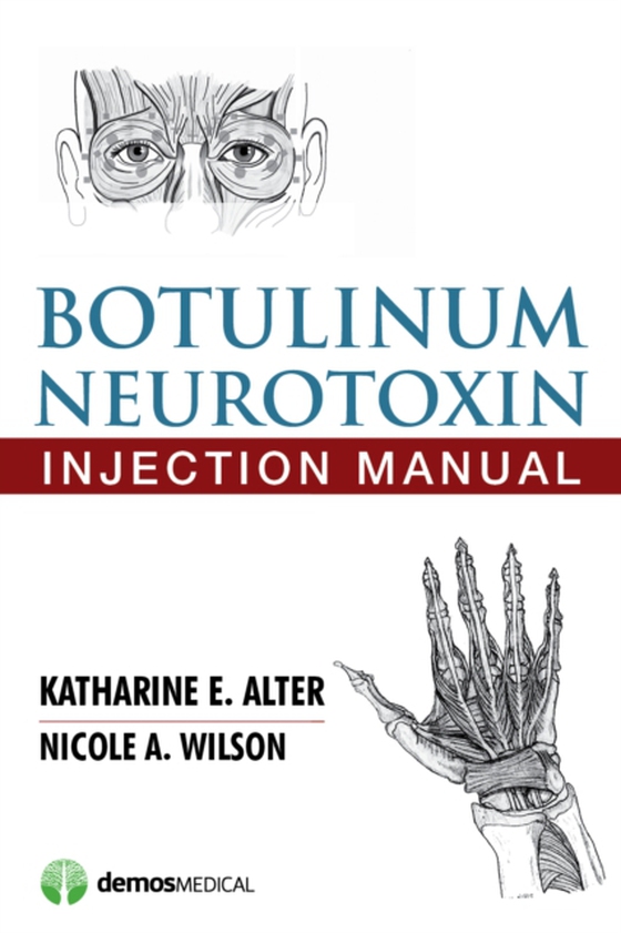 Botulinum Neurotoxin Injection Manual (e-bog) af Nicole A. Wilson, PhD, MD