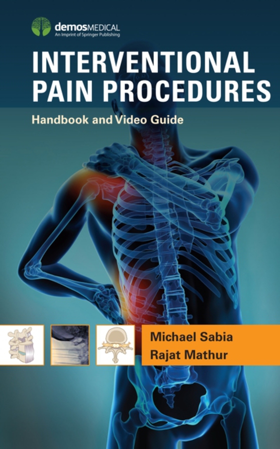 Interventional Pain Procedures (e-bog) af Rajat Mathur, MD