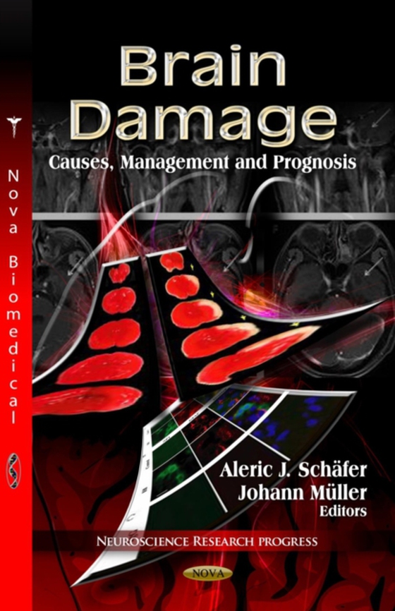 Brain Damage: Causes, Management and Prognosis (e-bog) af -