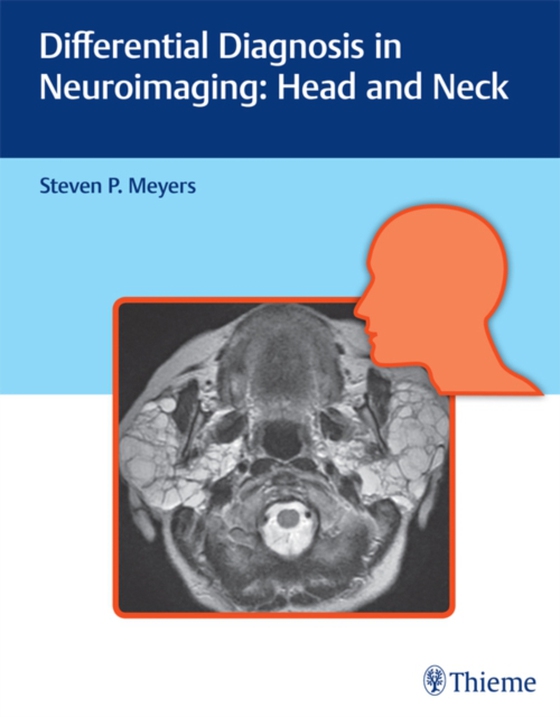 Differential Diagnosis in Neuroimaging: Head and Neck (e-bog) af -