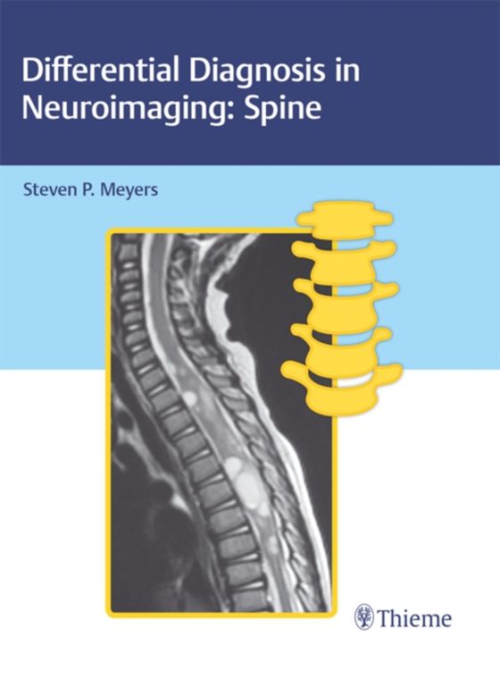 Differential Diagnosis in Neuroimaging: Spine (e-bog) af -