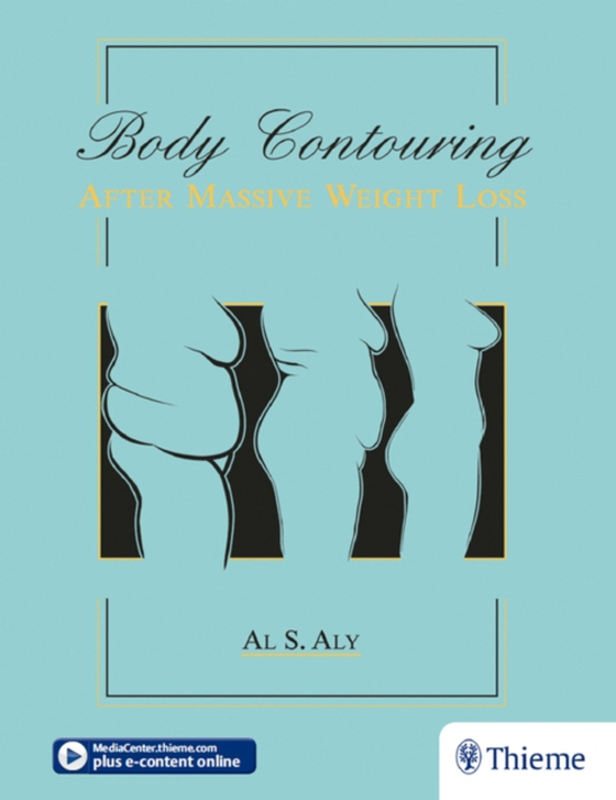 Body Contouring after Massive Weight Loss (e-bog) af -