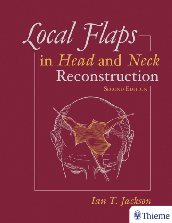 Local Flaps in Head and Neck Reconstruction (e-bog) af Jackson, Ian T.