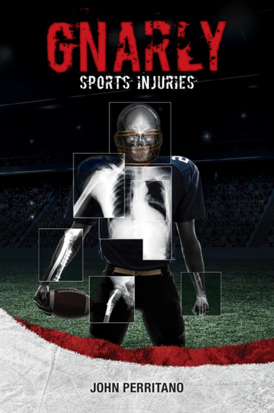 Gnarly Sports Injuries (e-bog) af John Perritano, Perritano