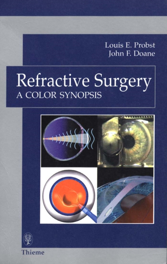 Refractive Surgery (e-bog) af Doane, John F.