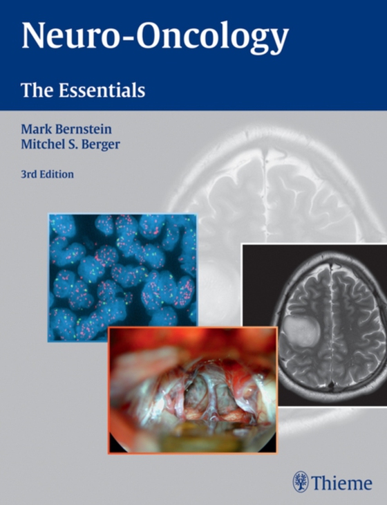 Neuro-Oncology: The Essentials (e-bog) af -