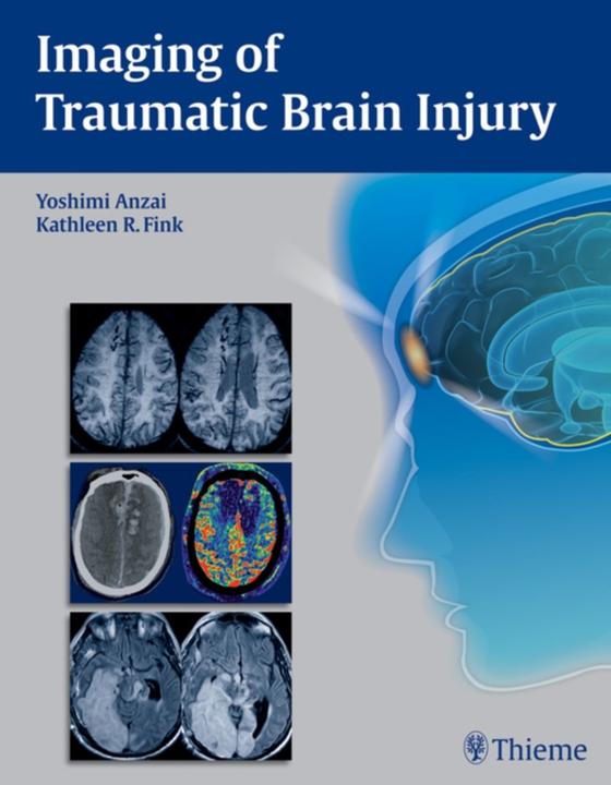 Imaging of Traumatic Brain Injury (e-bog) af -