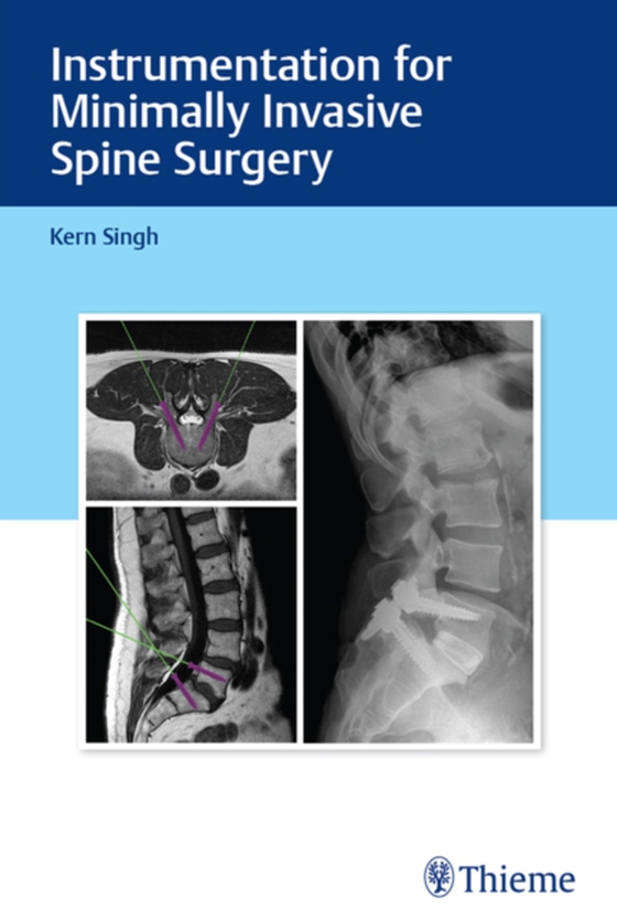 Instrumentation for Minimally Invasive Spine Surgery (e-bog) af Singh, Kern