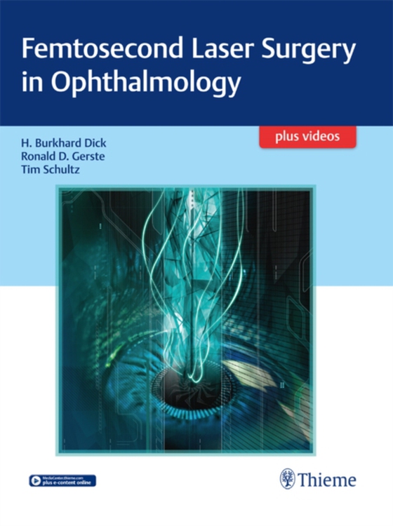 Femtosecond Laser Surgery in Ophthalmology (e-bog) af Schultz, Tim