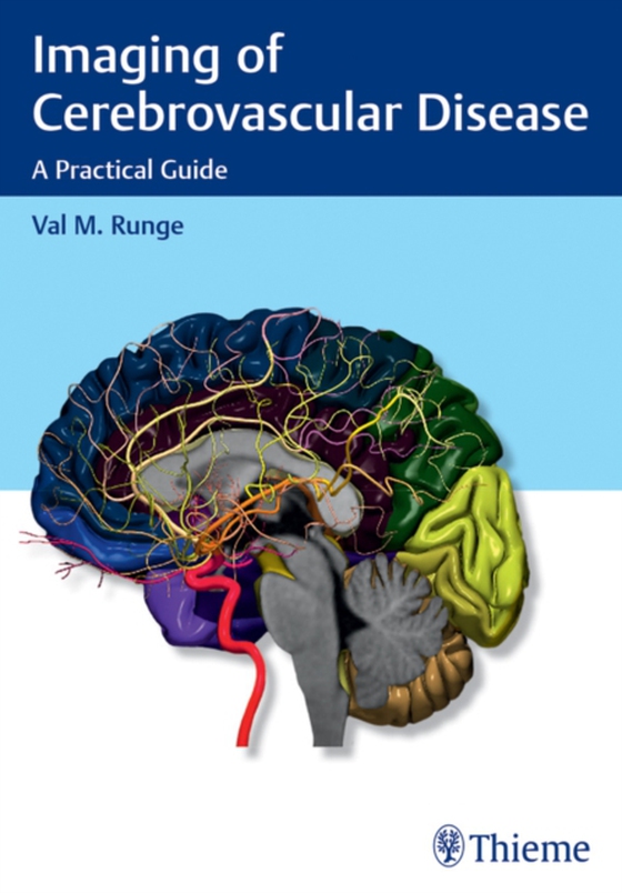 Imaging of Cerebrovascular Disease (e-bog) af Runge, Val M.