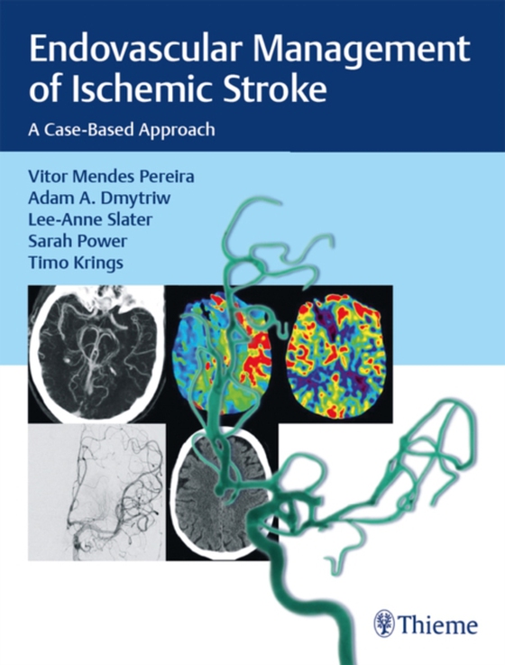 Endovascular Management of Ischemic Stroke (e-bog) af Slater, Lee-Anne