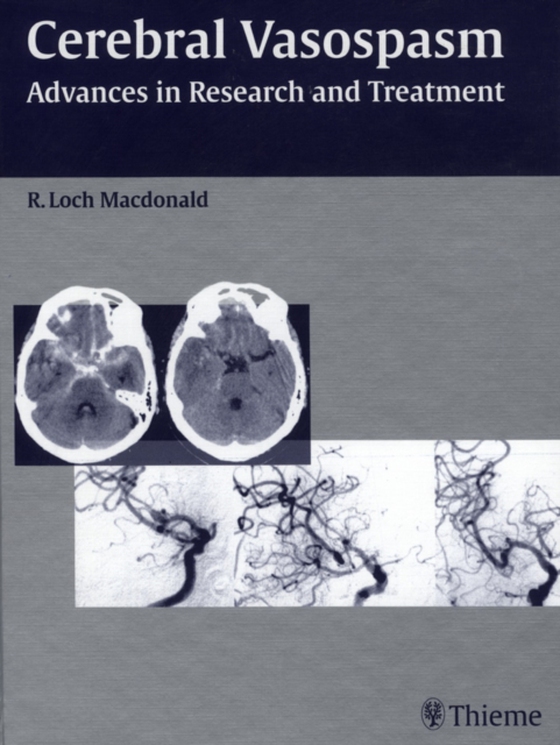 Cerebral Vasospasm (e-bog) af Macdonald, R. Loch