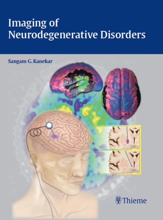 Imaging of Neurodegenerative Disorders (e-bog) af -