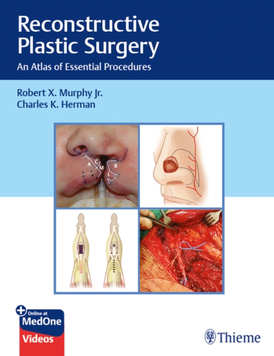 Reconstructive Plastic Surgery (e-bog) af -