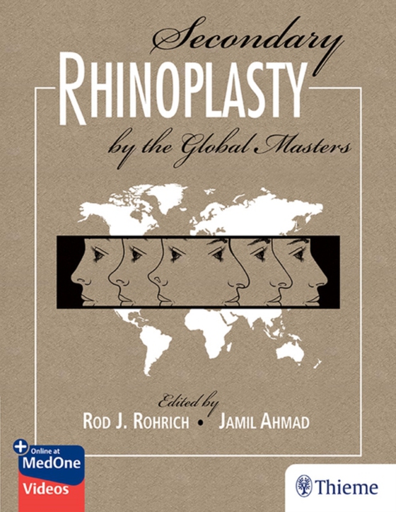 Secondary Rhinoplasty by the Global Masters (e-bog) af Ahmad, Jamil